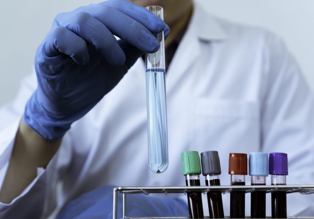 The hands of a laboratory technician with test tubes samples and shelves with other samples / laboratory technicians that collect test tubes for Detection
